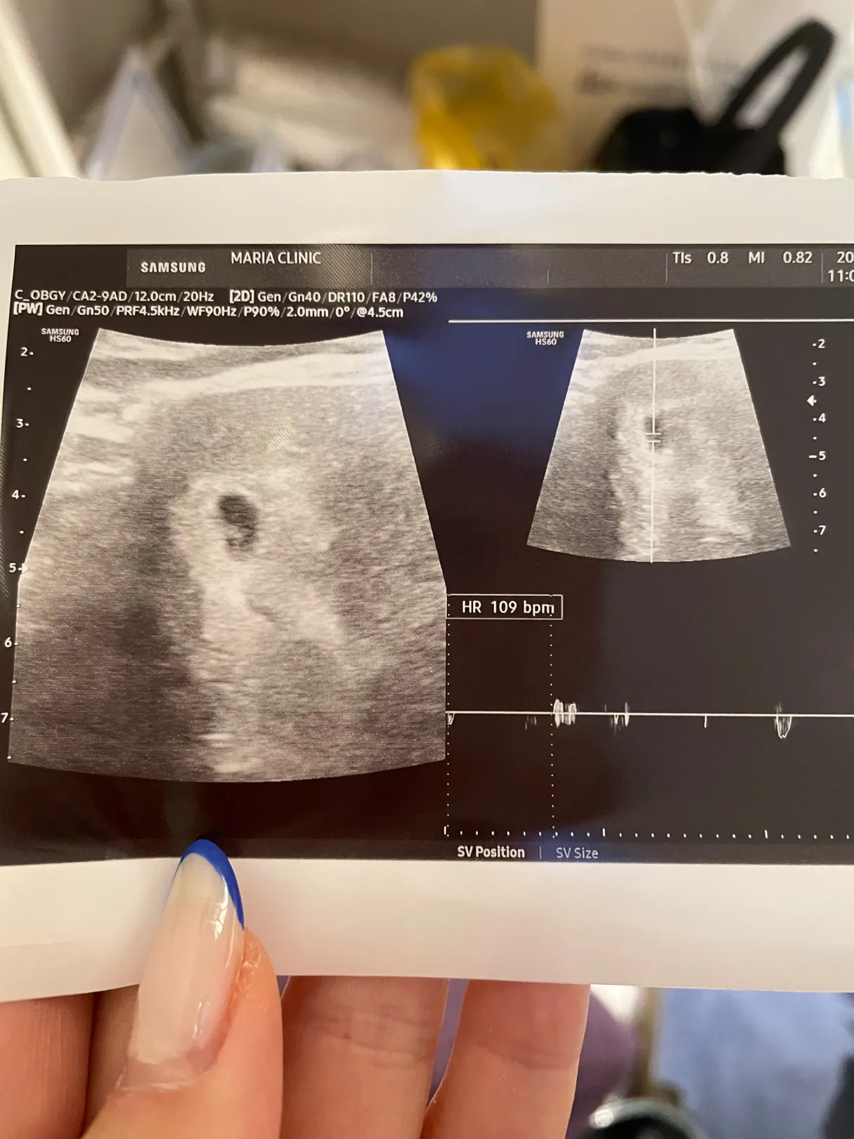 6주6일 심소 듣고왔는데 다들 보통 몇bpm 나왔나요?