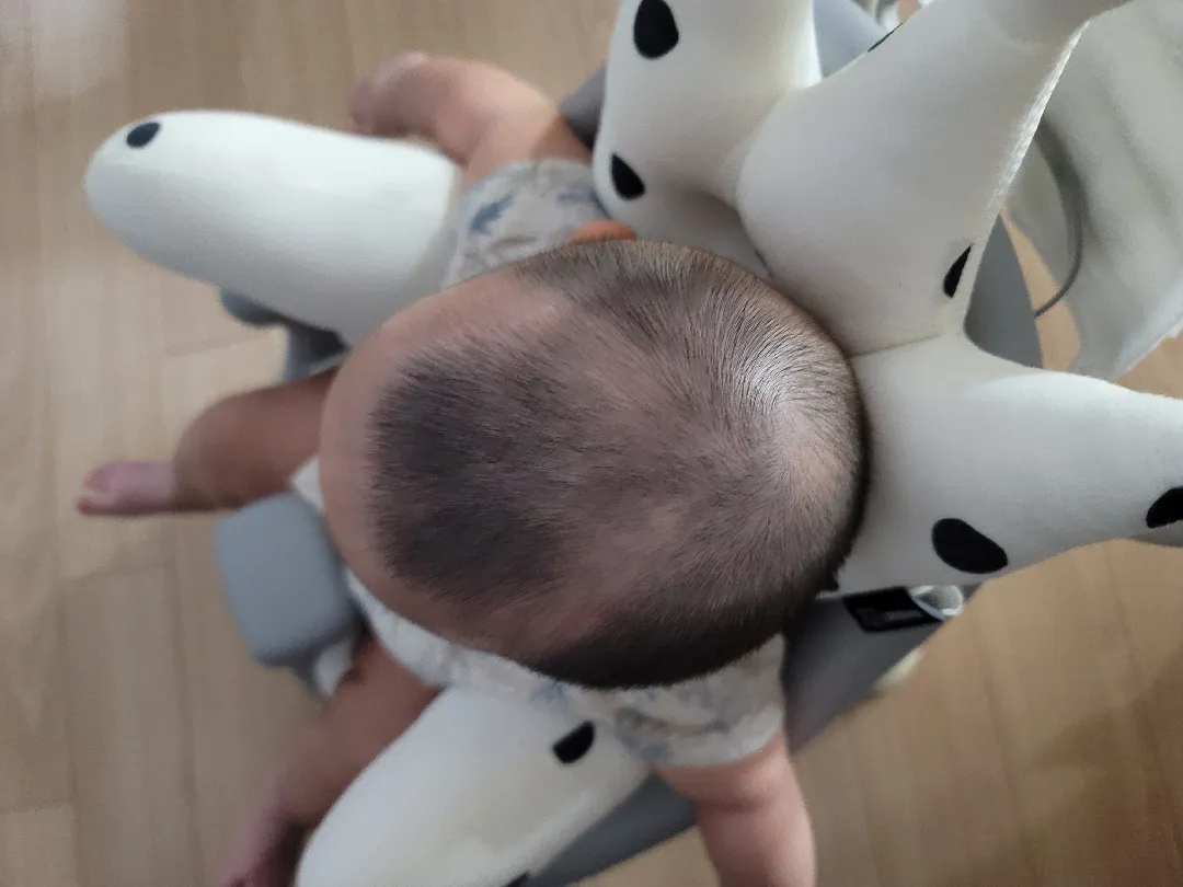 아기 머리 이게 뭘까요?!