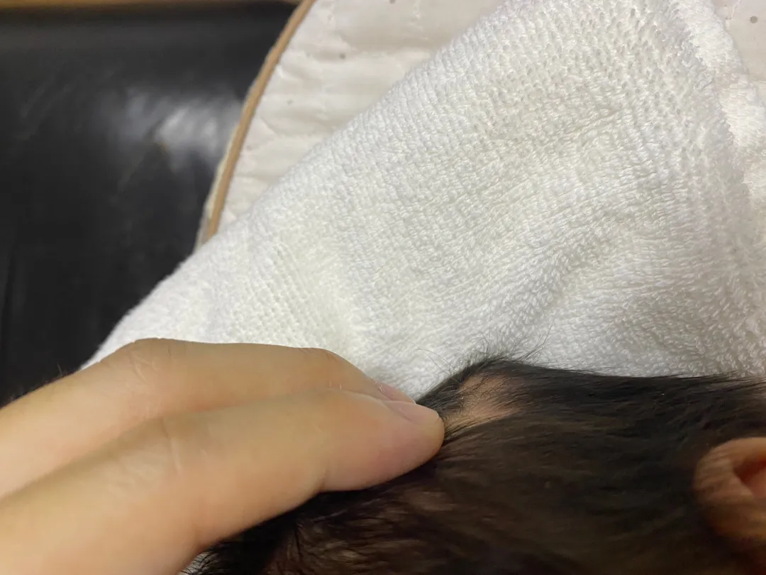  아기 뒷통수에 볼록하게 튀어나온 부분..