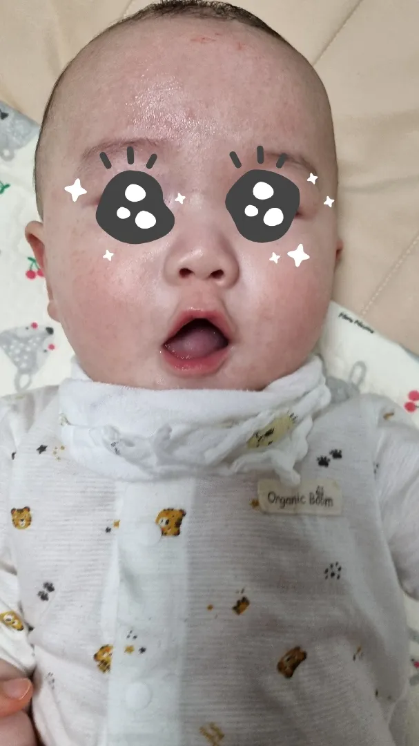 아기피부 어떻게해야할지 감이 안잡혀요 ㅠㅠ