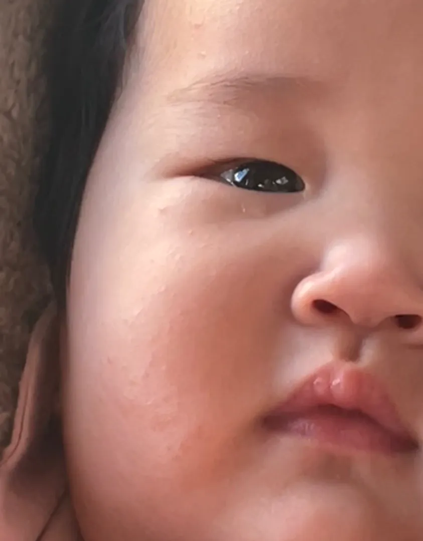 로션을 바꿔야할까요?