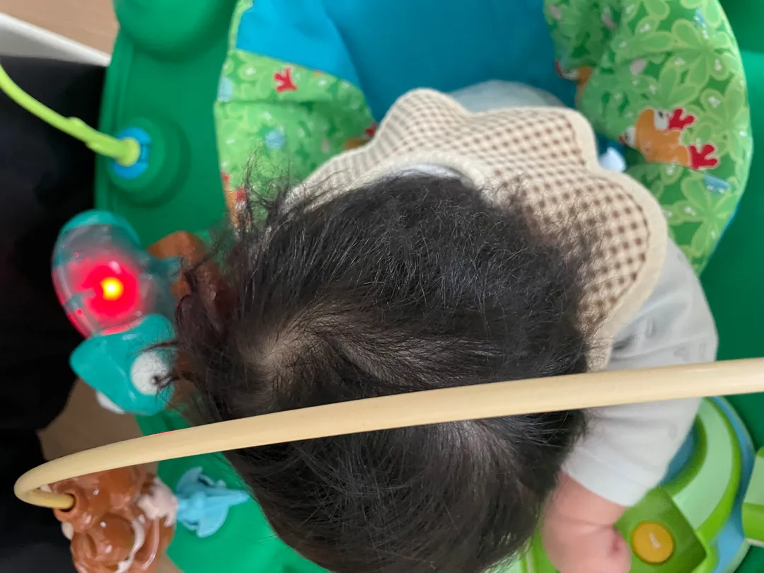 아기 머리가 엉키는데 삭발해야할까요??