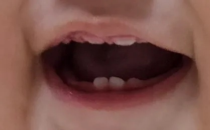 이 얼만큼 나왔나요?