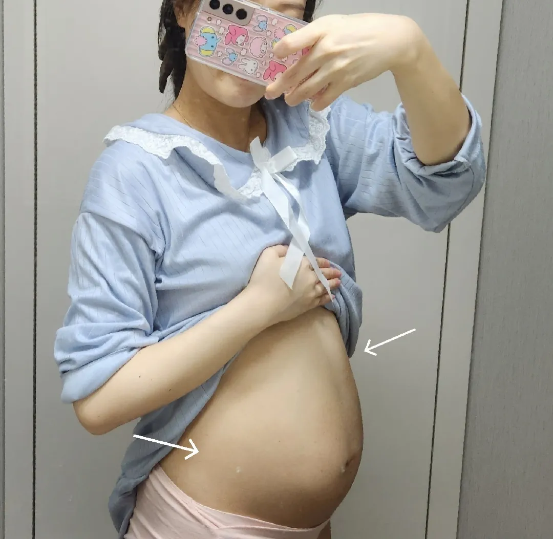 community post image