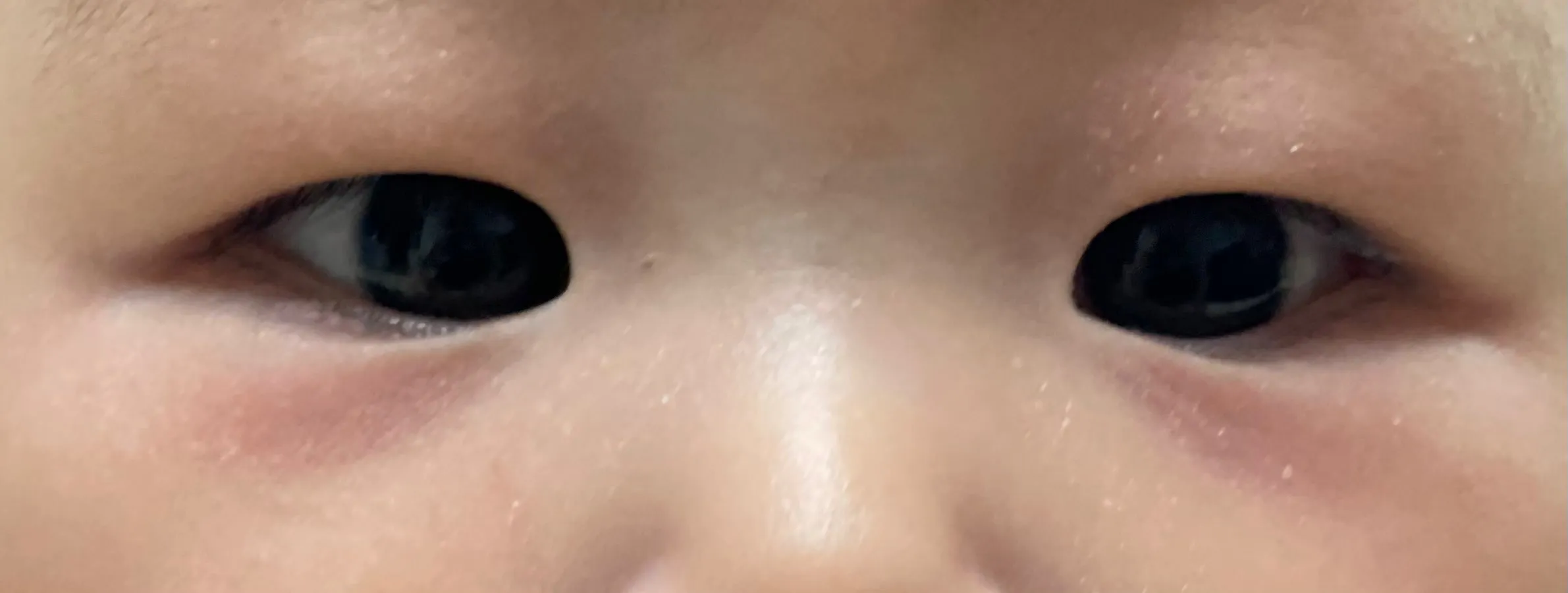 아기 눈가 왜이럴까요?