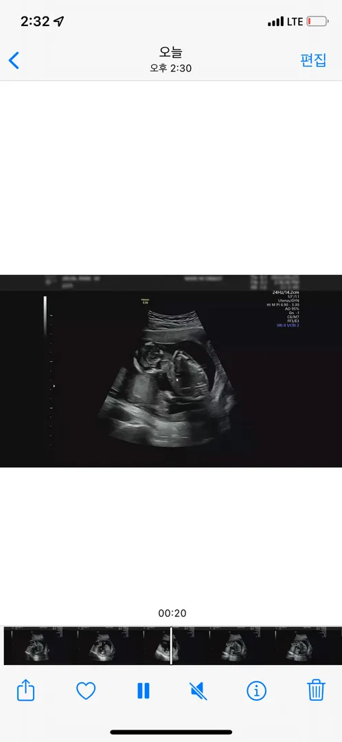 community post image