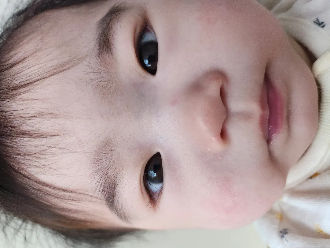 이거 알레르기인가요?