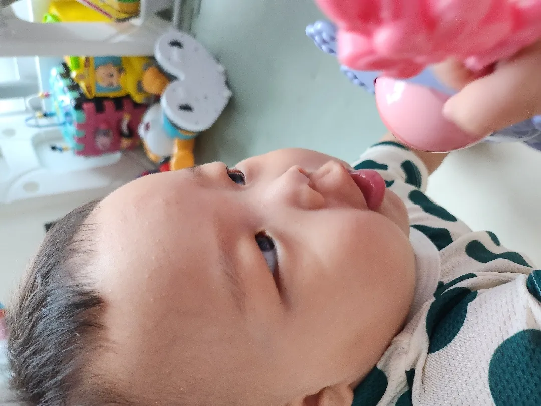 아기 피부 봐주세요!!