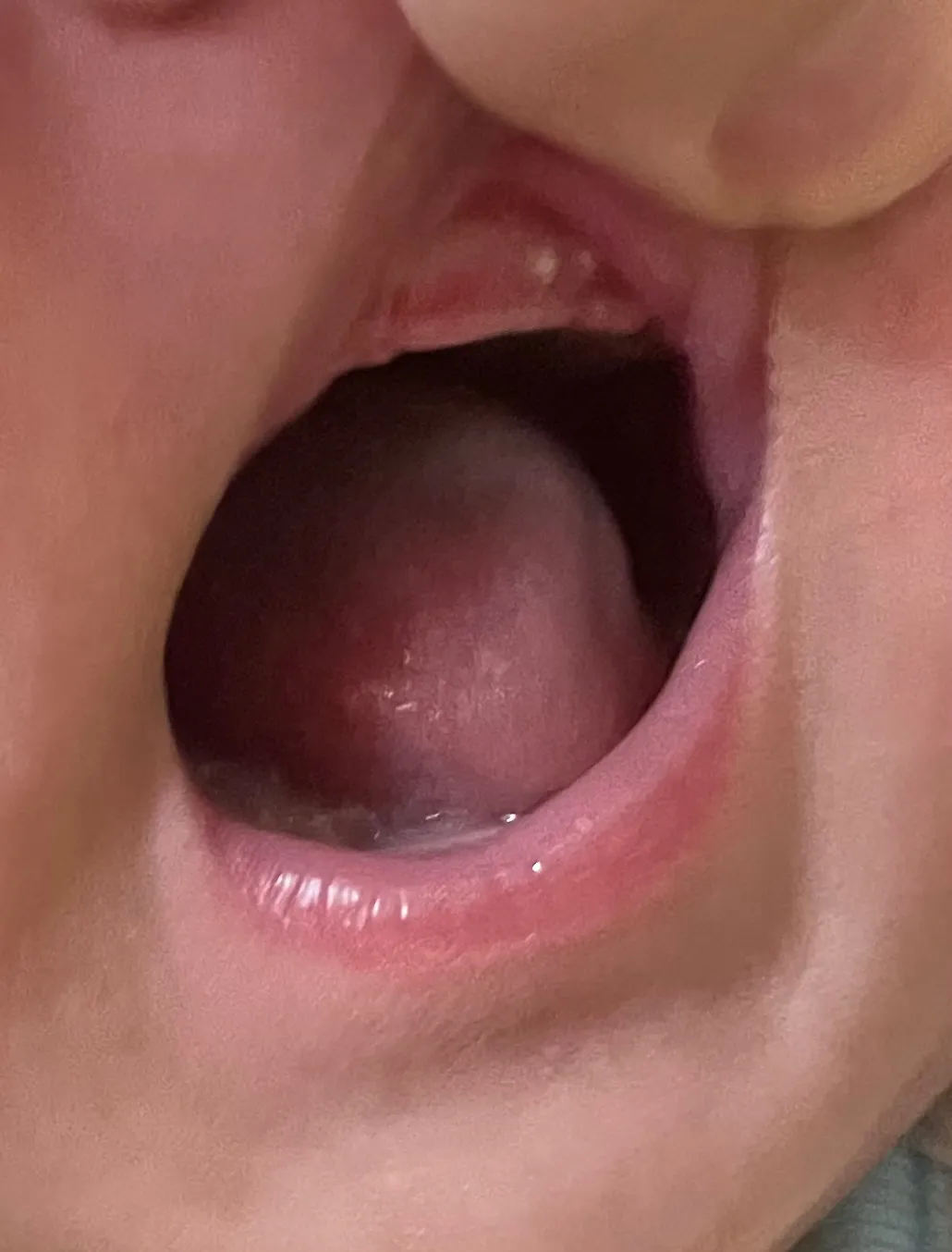 잇몸 이게 뭘까요???