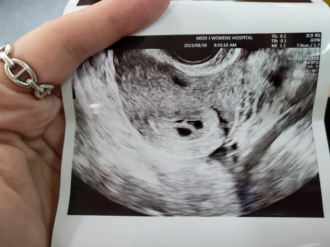 쌍둥이.. 그리고 더이상은 아니겠죠? 