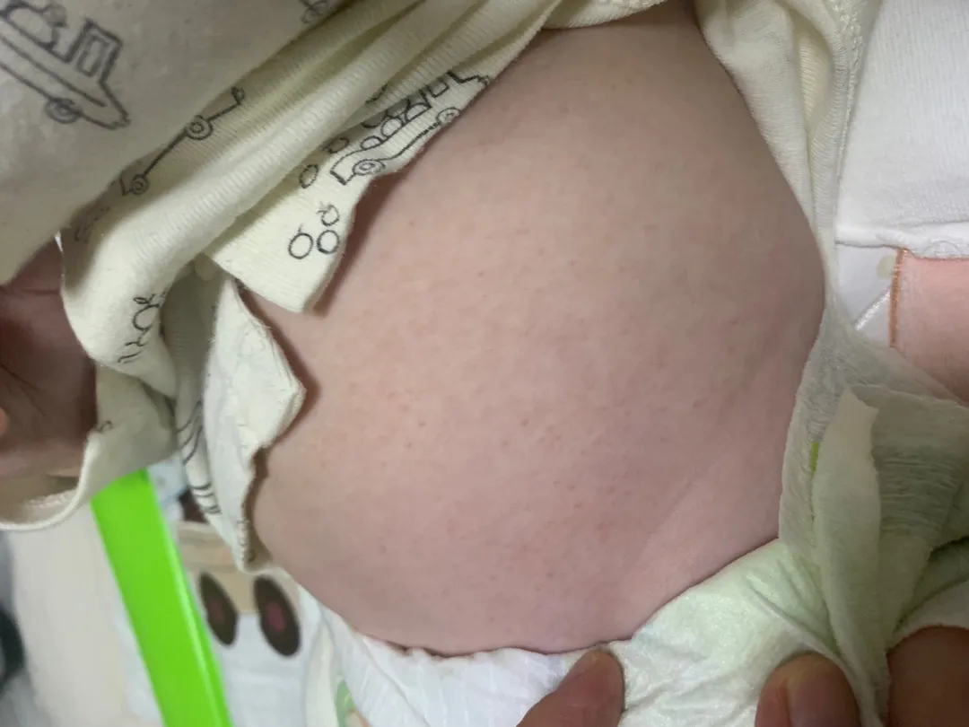 아기피부 이게 뭘까요??