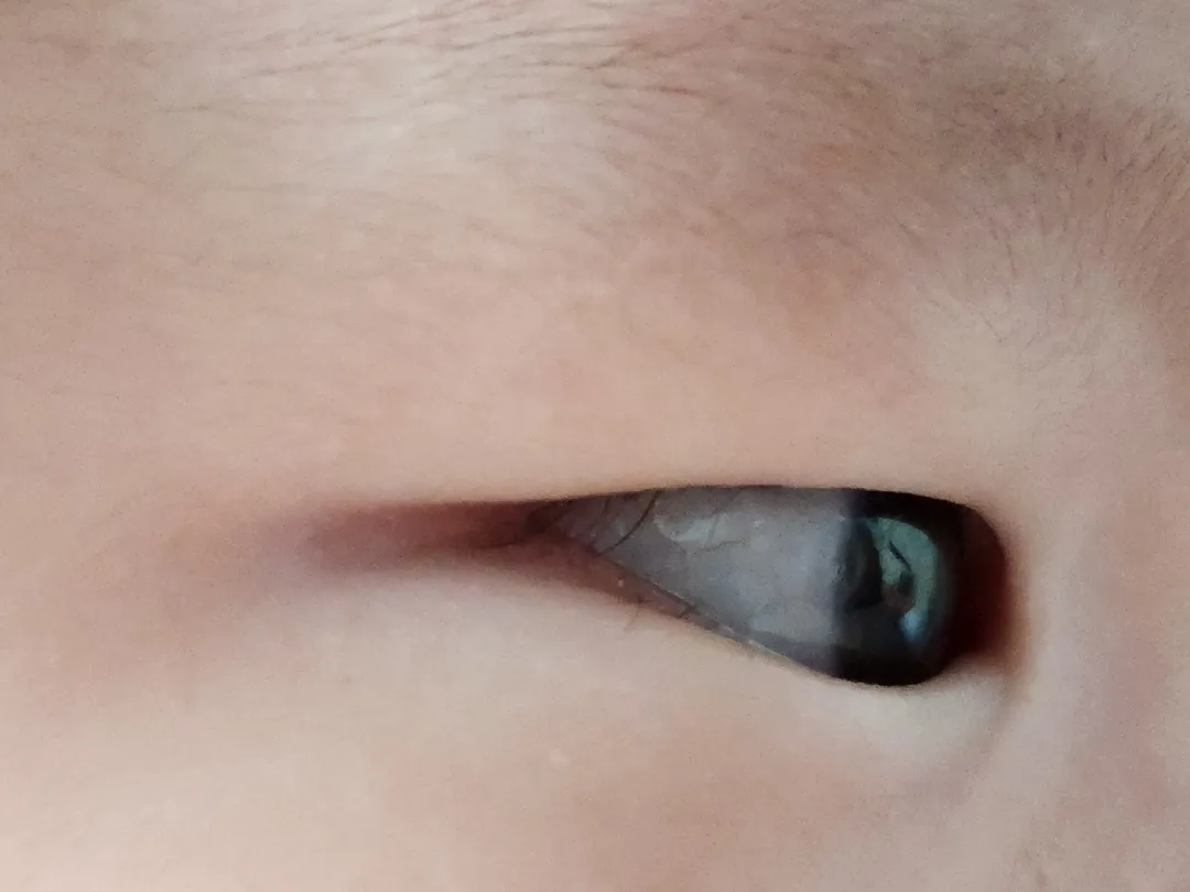 눈안에 속눈썹 괜찮은건가요...?