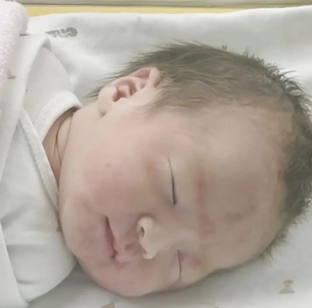 37주6일 우리코코 태어났어요♡(제왕3일째)