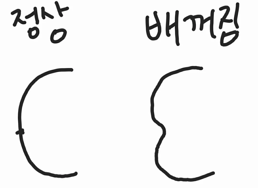 community post image