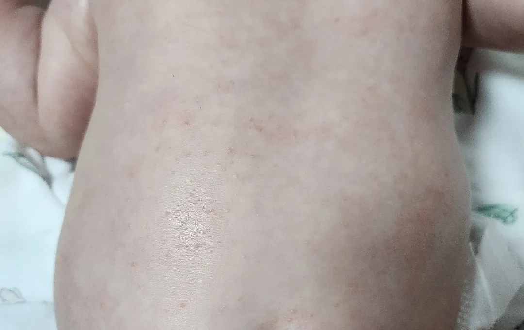 애기 몸에 이게 뭘까요?ㅜㅜ