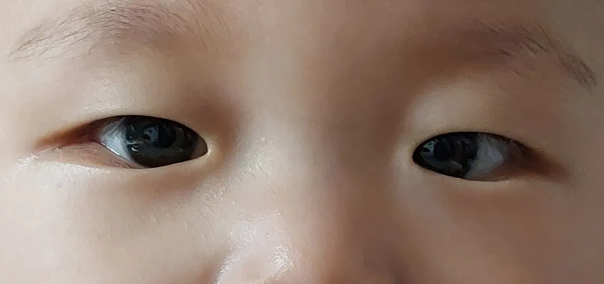 아기 눈이 안쪽으로 몰리시는분?