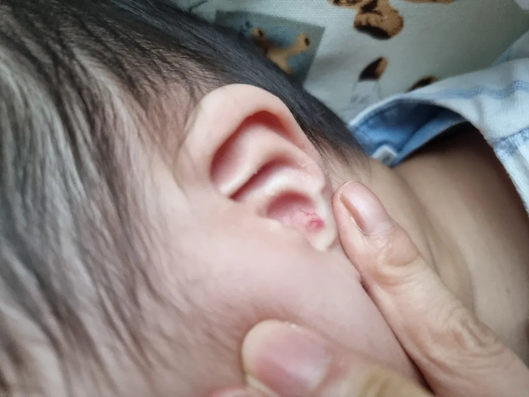 자는아기 땀..
