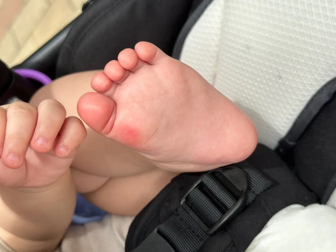 발이 왜 이럴까요??