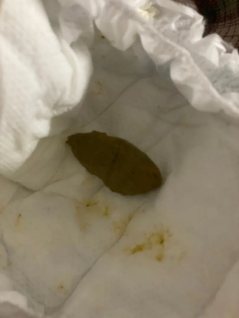 응가한번봐주세요/사진있음