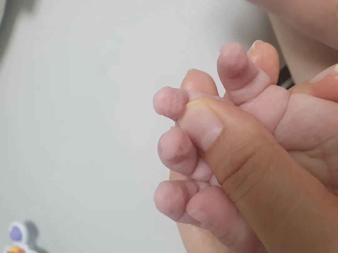 손이 쭈글쭈글