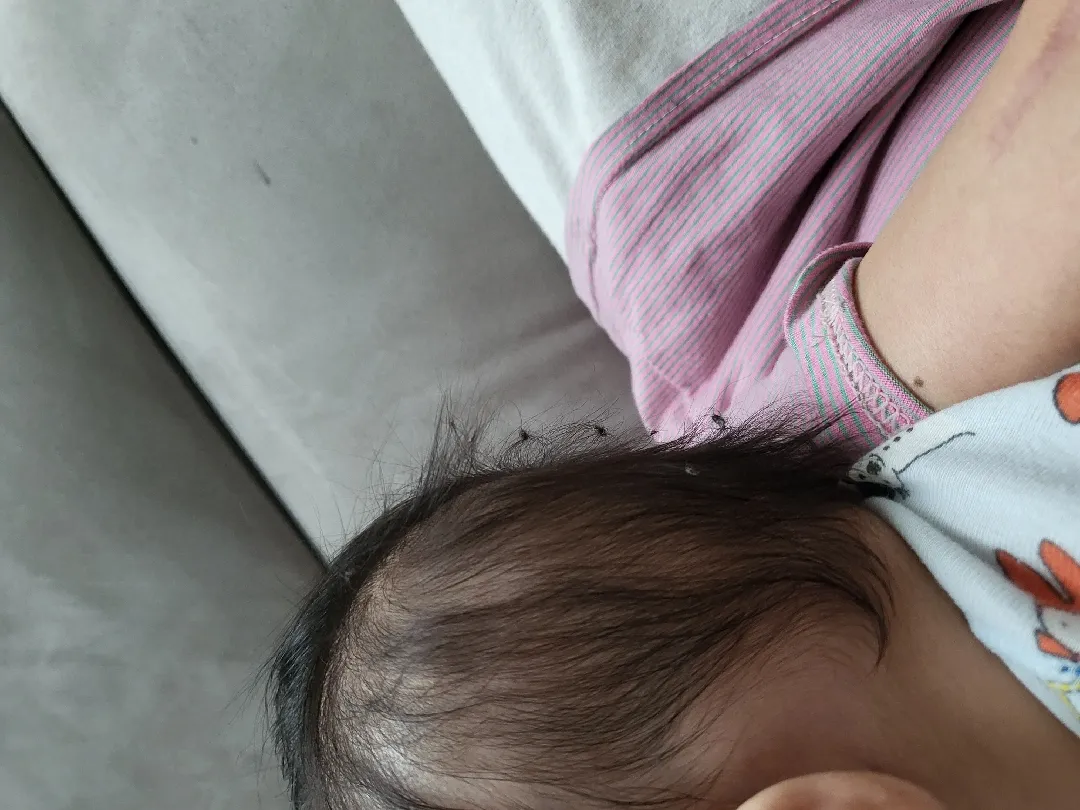 뒷머리자꾸엉키네요ㅠㅜ