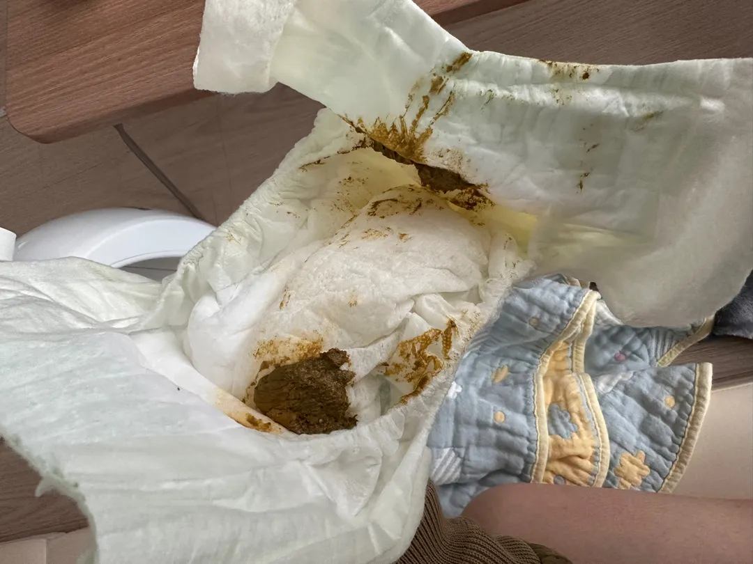 응가색 괜찮은건가요 ㅠㅠ? (사진있습니당!)
