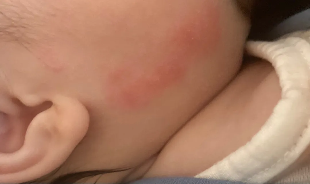 피부좀 봐쥬세요😭