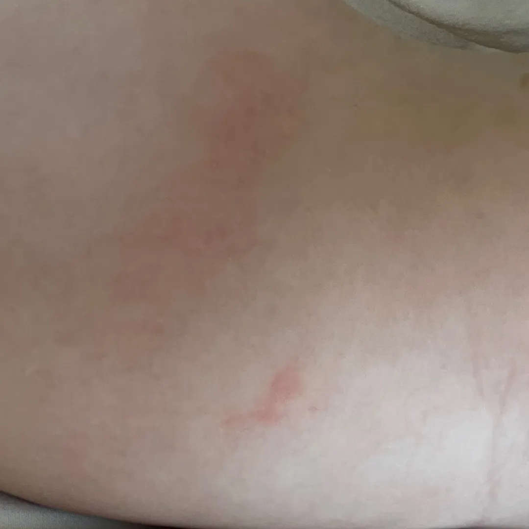 밀가루 알러진가요..?