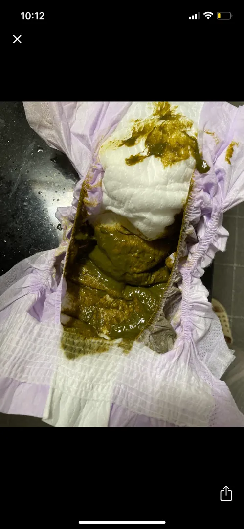(사진 주의) 이것도 설사인가요??