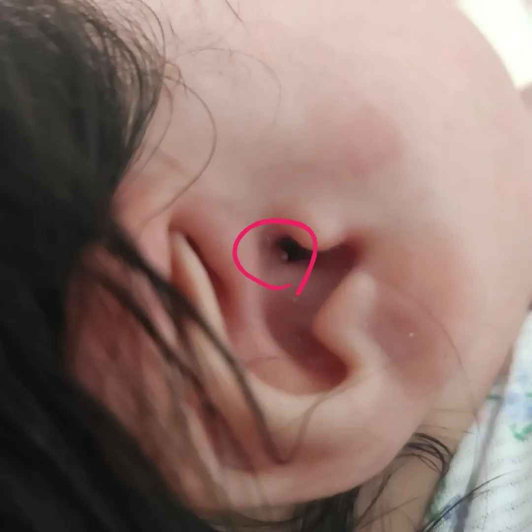 귀 속 좀 봐주세요 ㅠㅠ