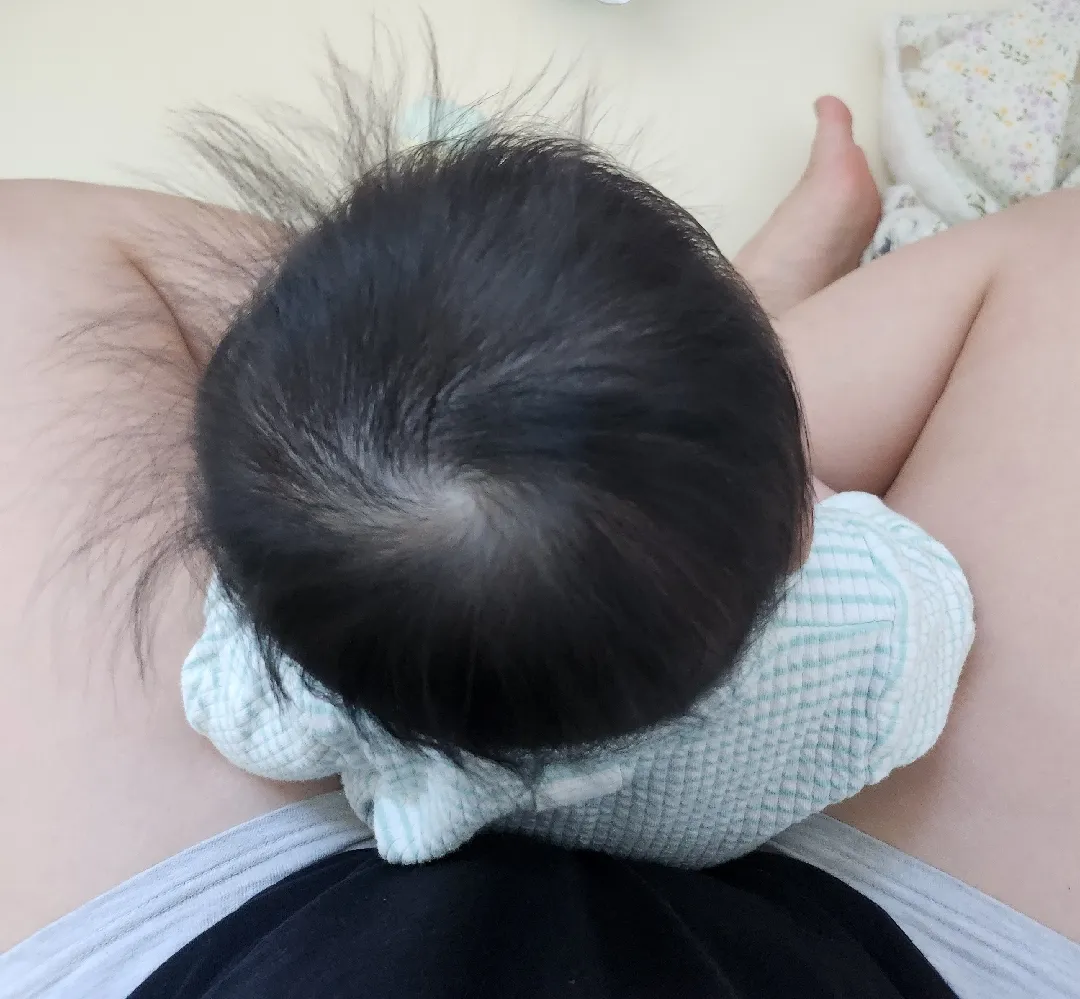 단두증일까요?!