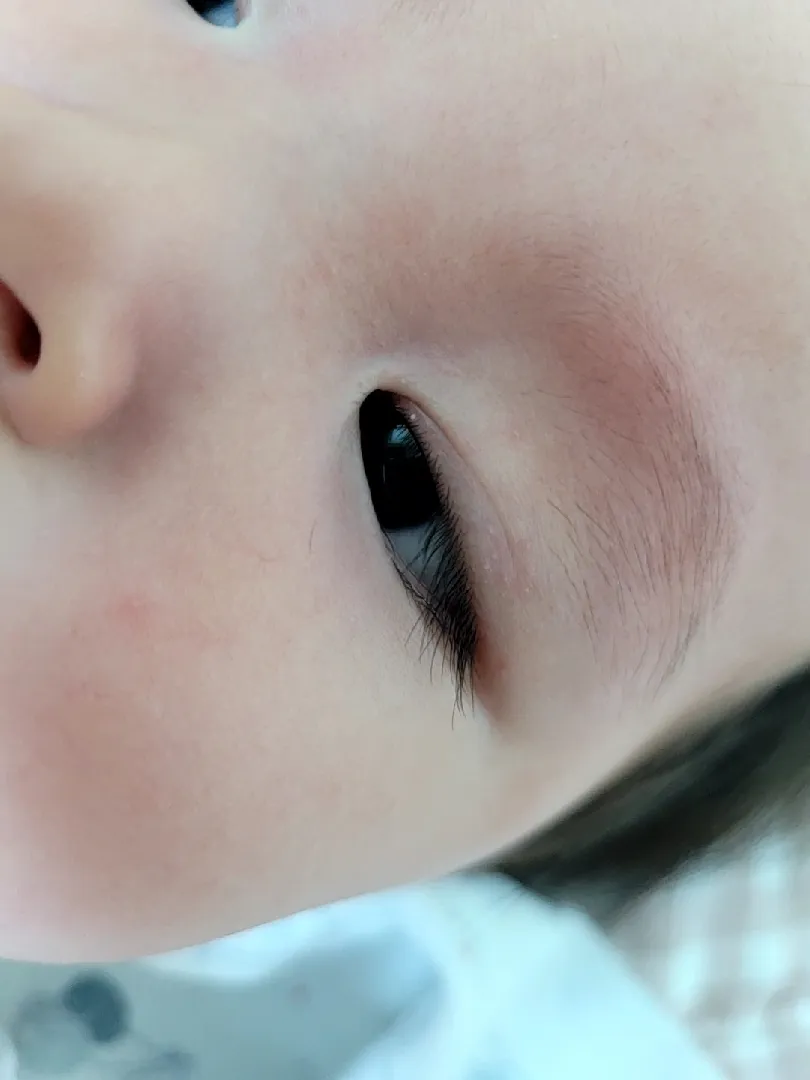 아가 속눈썹 뿌리 부분에 하얗게 뭐가 있는데용