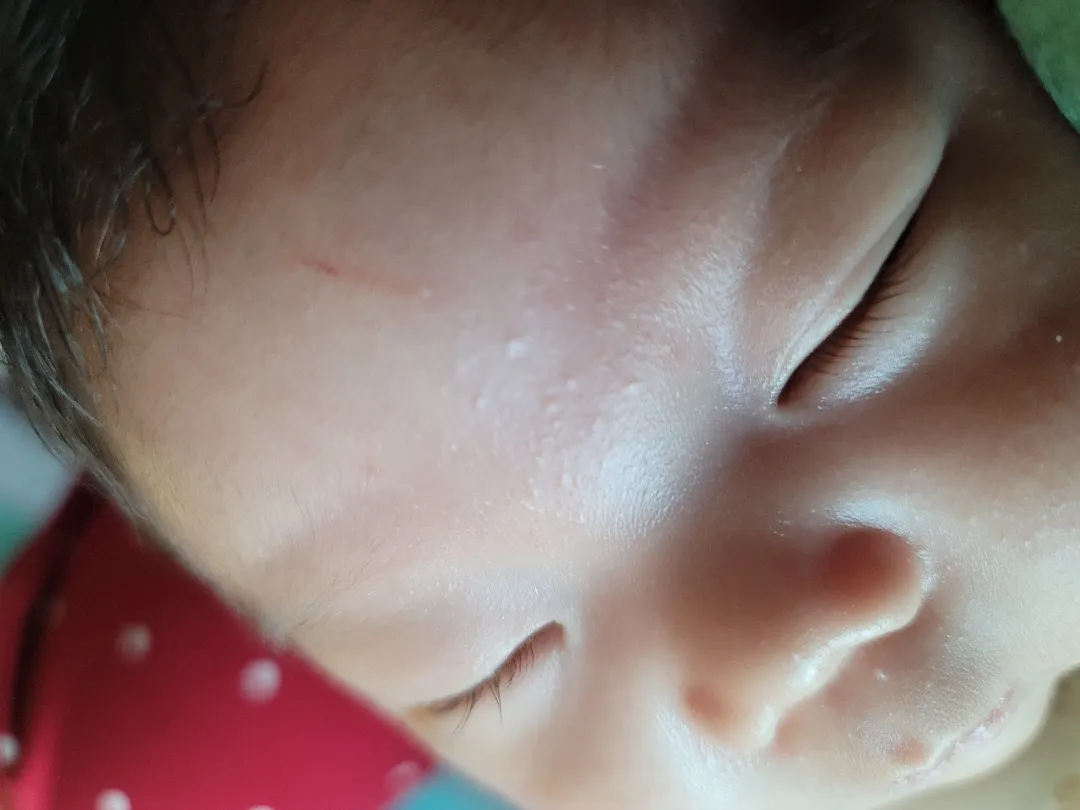 태열 자국? 흔적? 