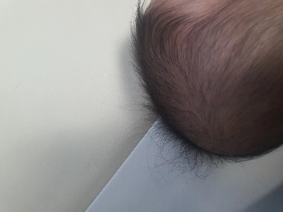 몇가닥씩 긴머리는 뭘까요?