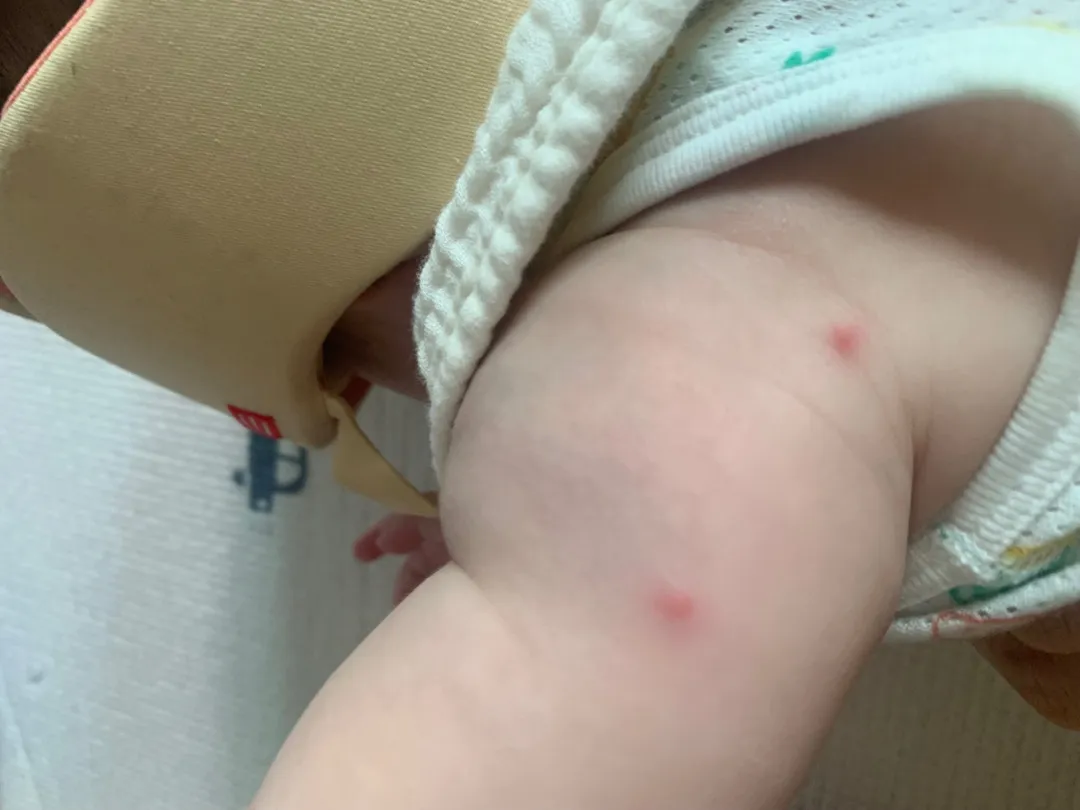 모기퇴치 ㅠㅠ