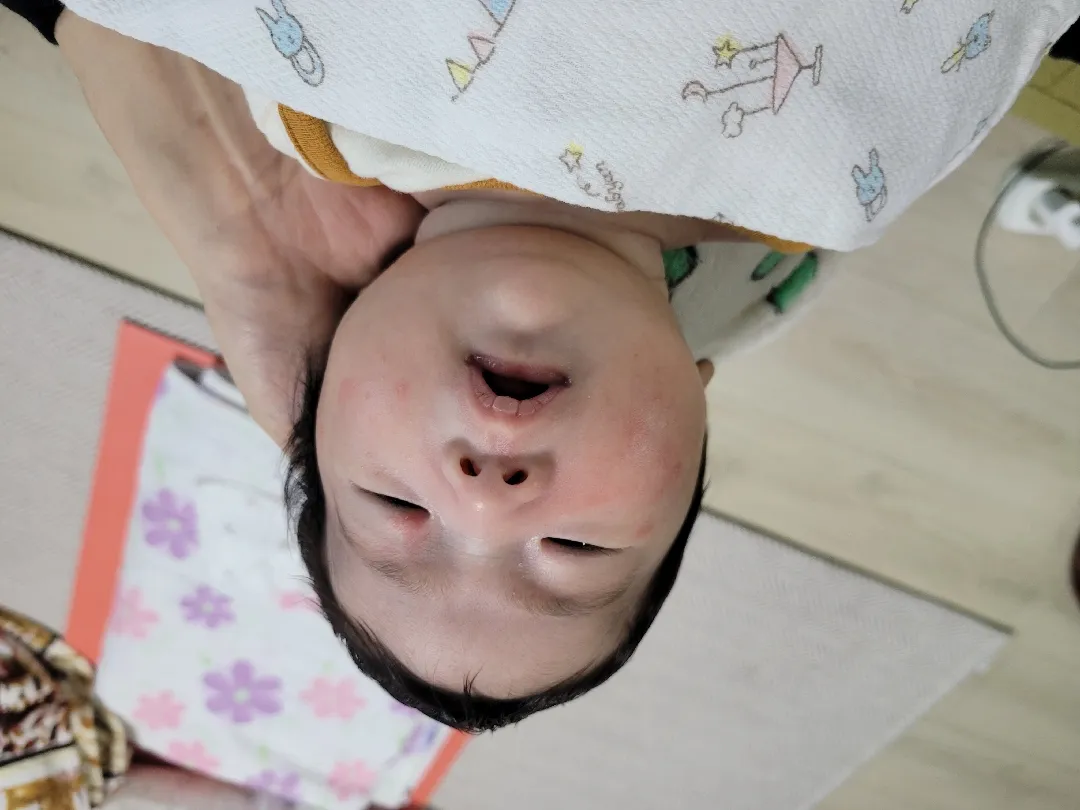 40일 아기피부 ㅜㅜ 두드러기?