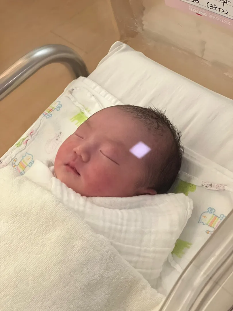 제왕절개 솔직후기 !