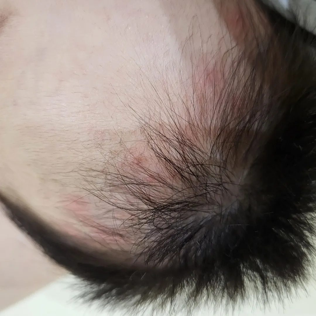 태열일가요?