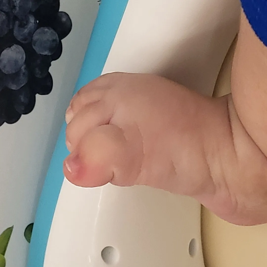 아기 발톱때문에 병원갔다왔네요.