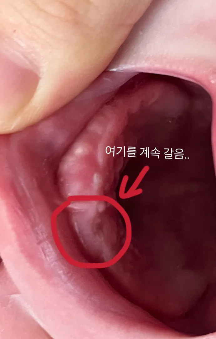 🦷를 갈아요...