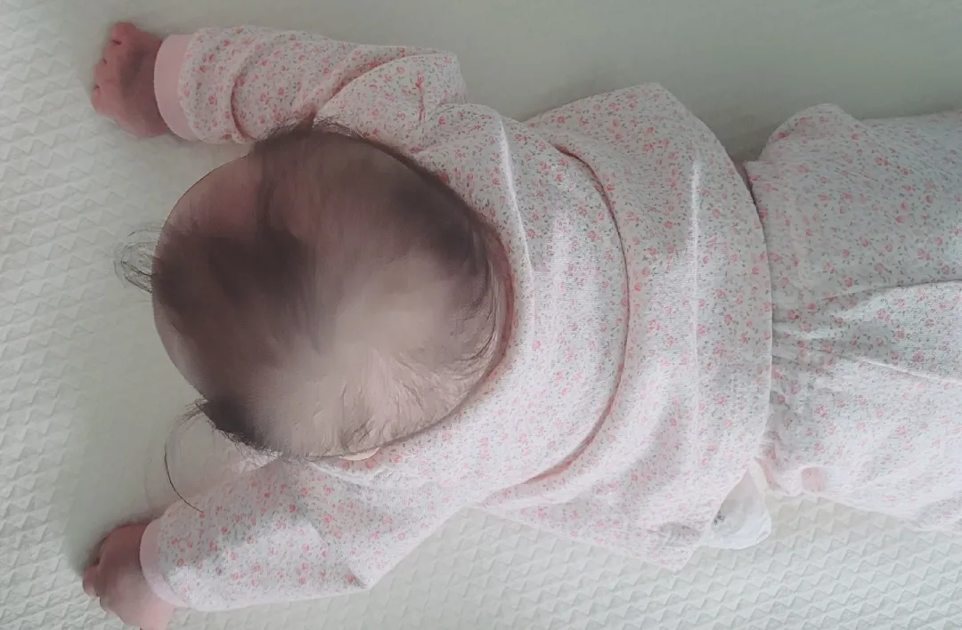 아기 사두증 대학병원가봐야할까요??