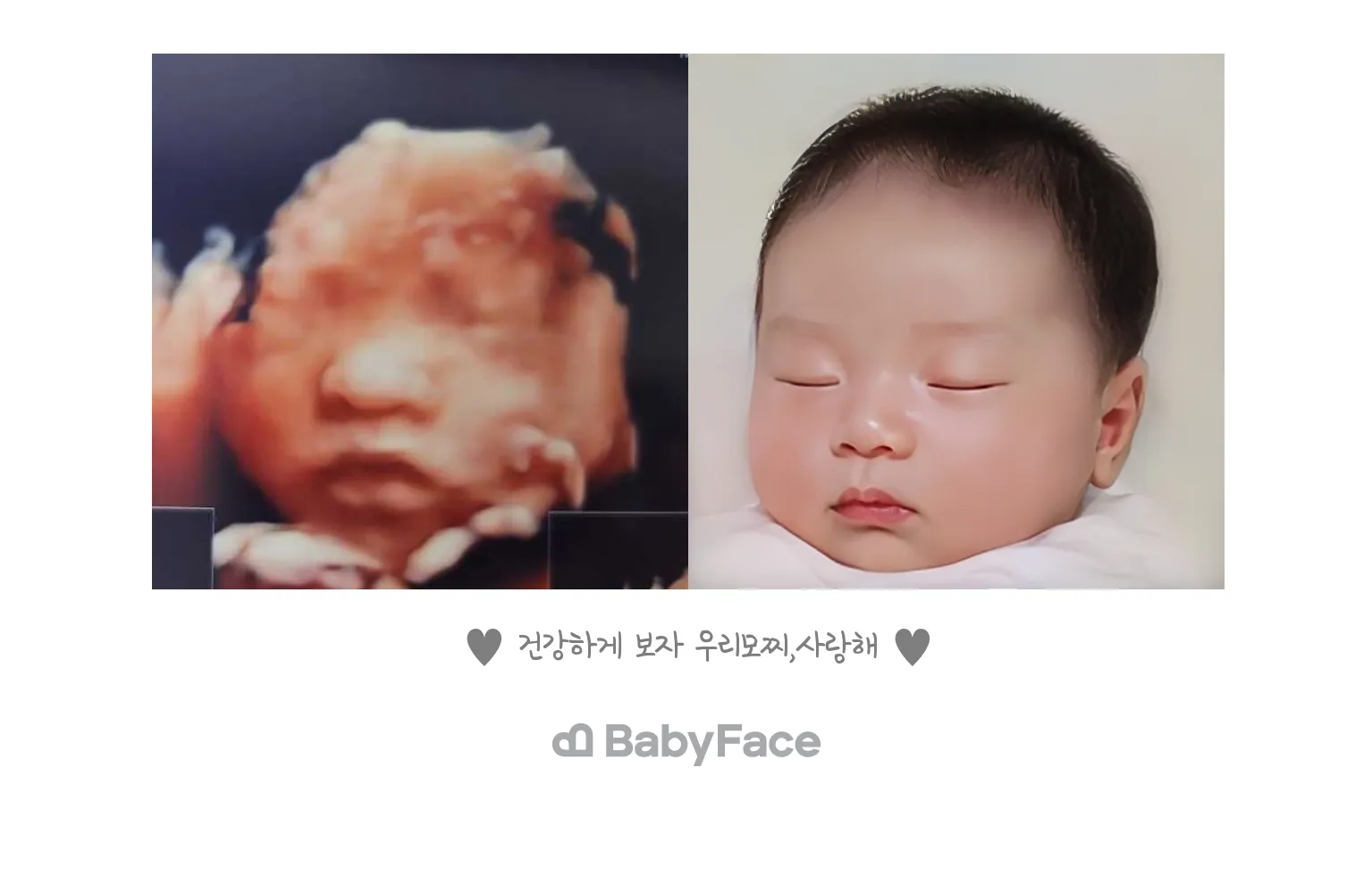 2차입체초음파하고 베이비페이스했어요^^
