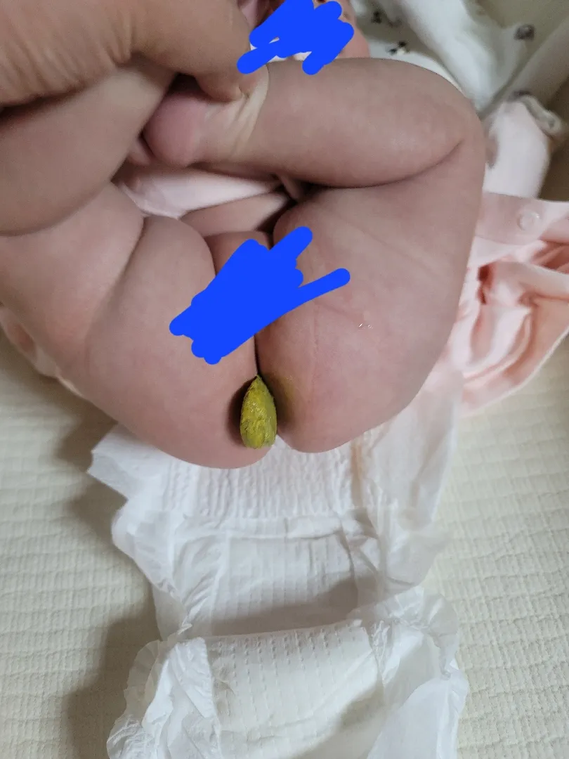 아기 대변