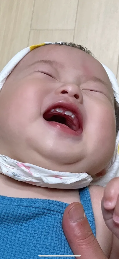 앞니 사이가 벌어진거 같은데ㅠㅠ