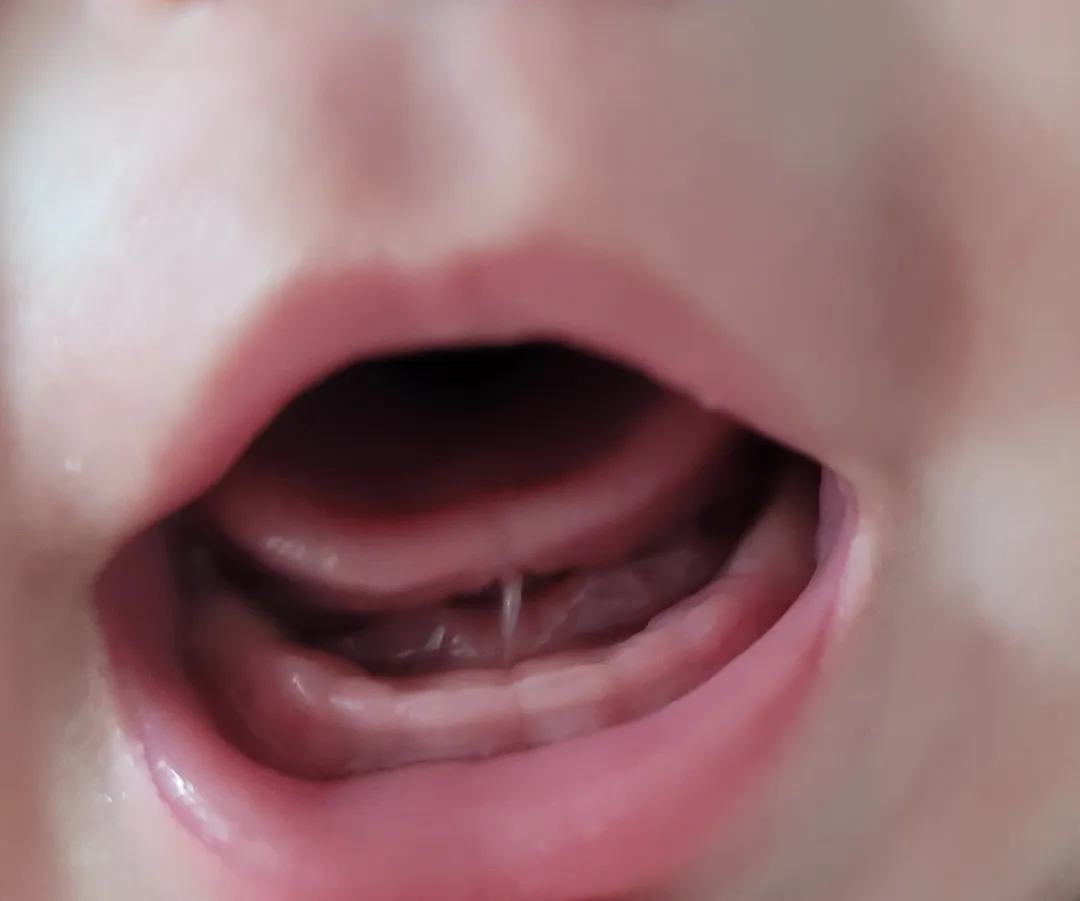 벌써 이앓이를 하나봐요!..