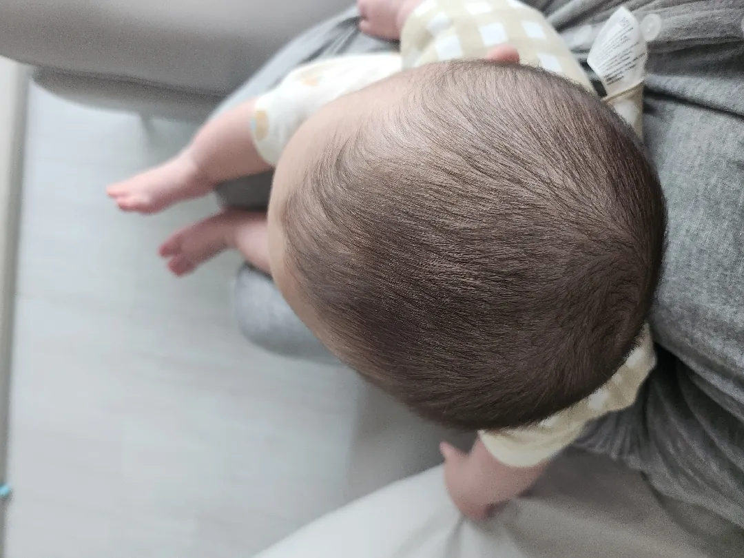 단두증인지 봐주세요...
