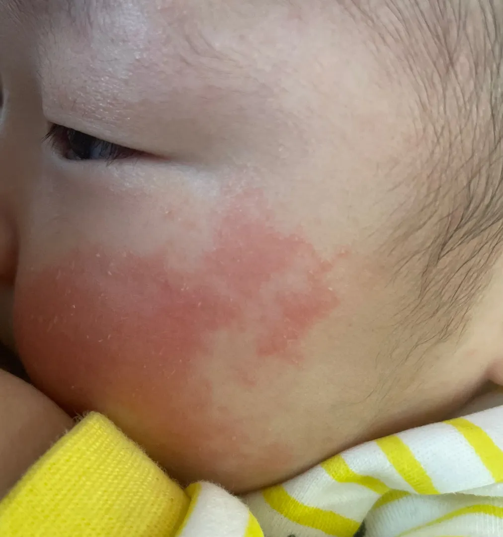 피부 좀 봐주세요.. ㅠ