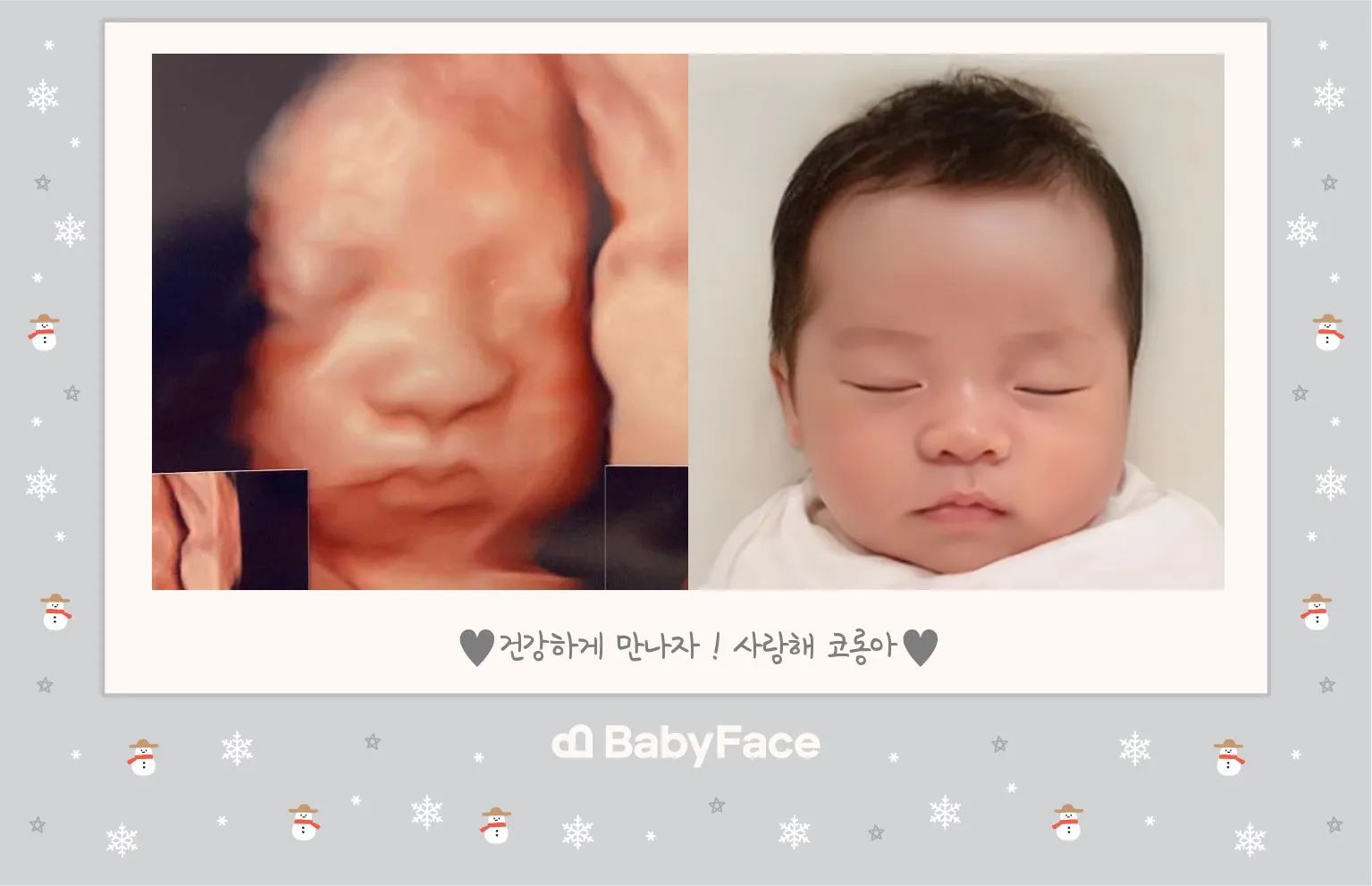 저두 베이비 페이스 했어요❤️