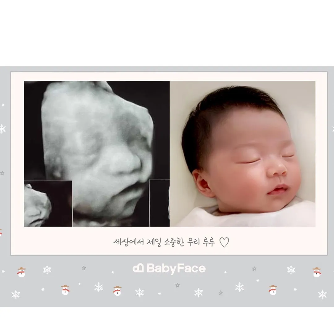 베이비페이스 28주차 했습니다! 