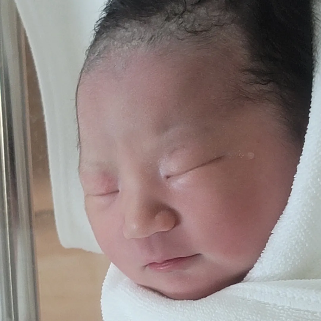 [37주 6일]제왕절개 후기